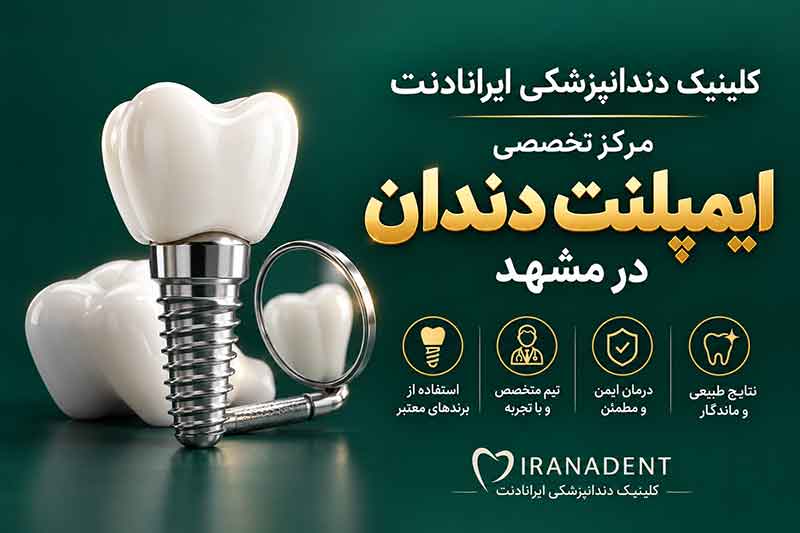 ایمپلنت دندان در کلینیک دندانپزشکی ایرانادنت