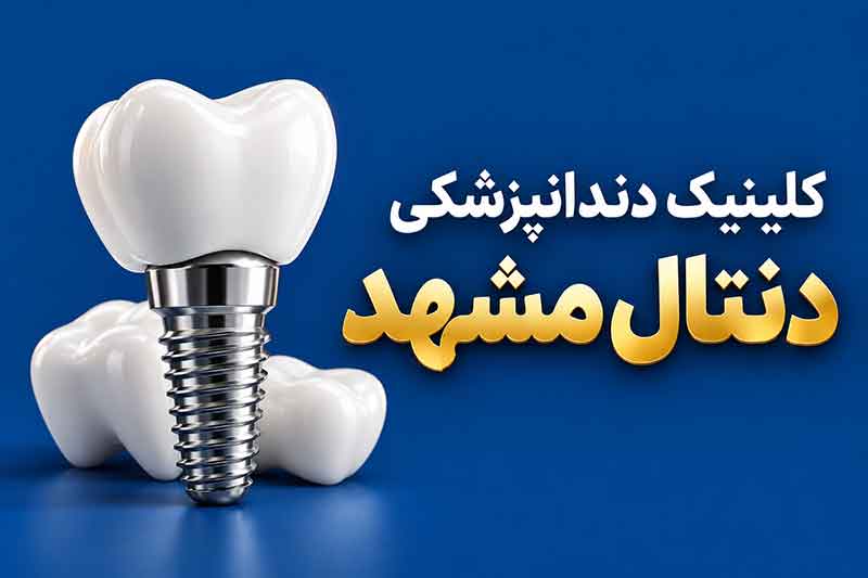دنتال مشهد